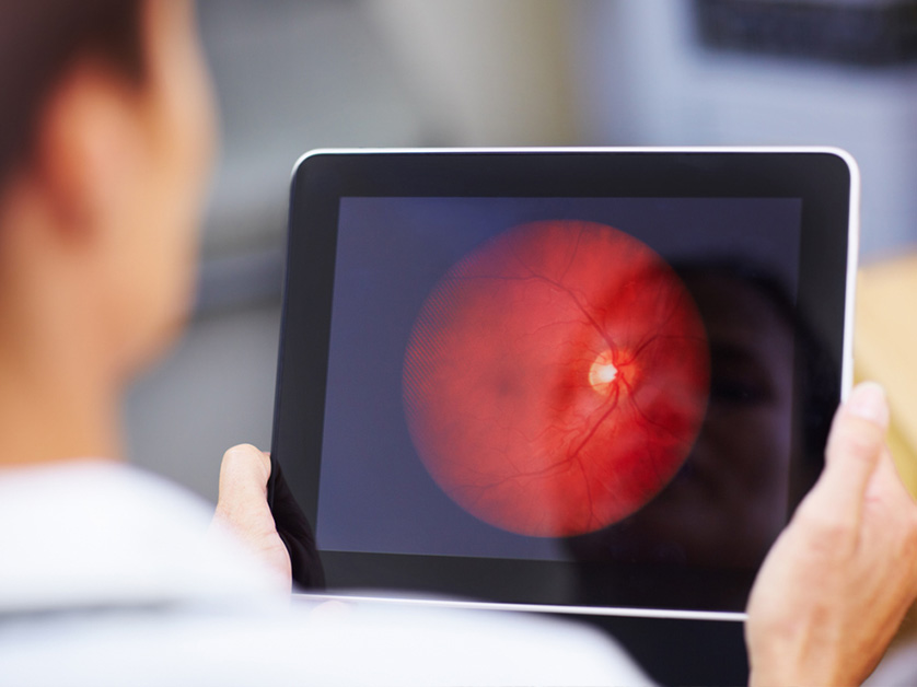 The Importance of Retinal Imaging