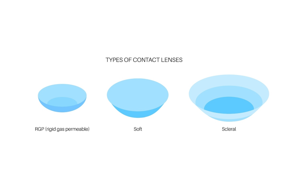 Diagram comparing rigid gas permeable, soft, and scleral contact lenses, showing the larger size and deeper curvature of scleral lenses.