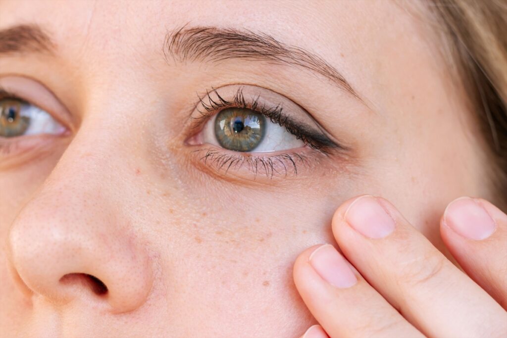 Close up image of woman with age spot freckles around eye.